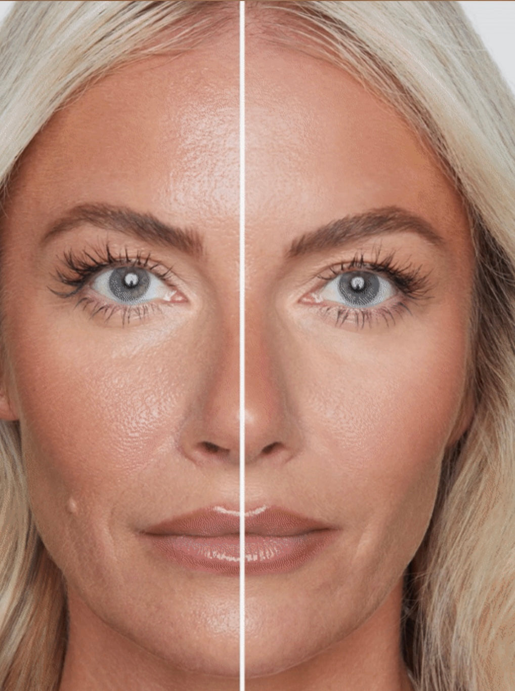 Skin Finish