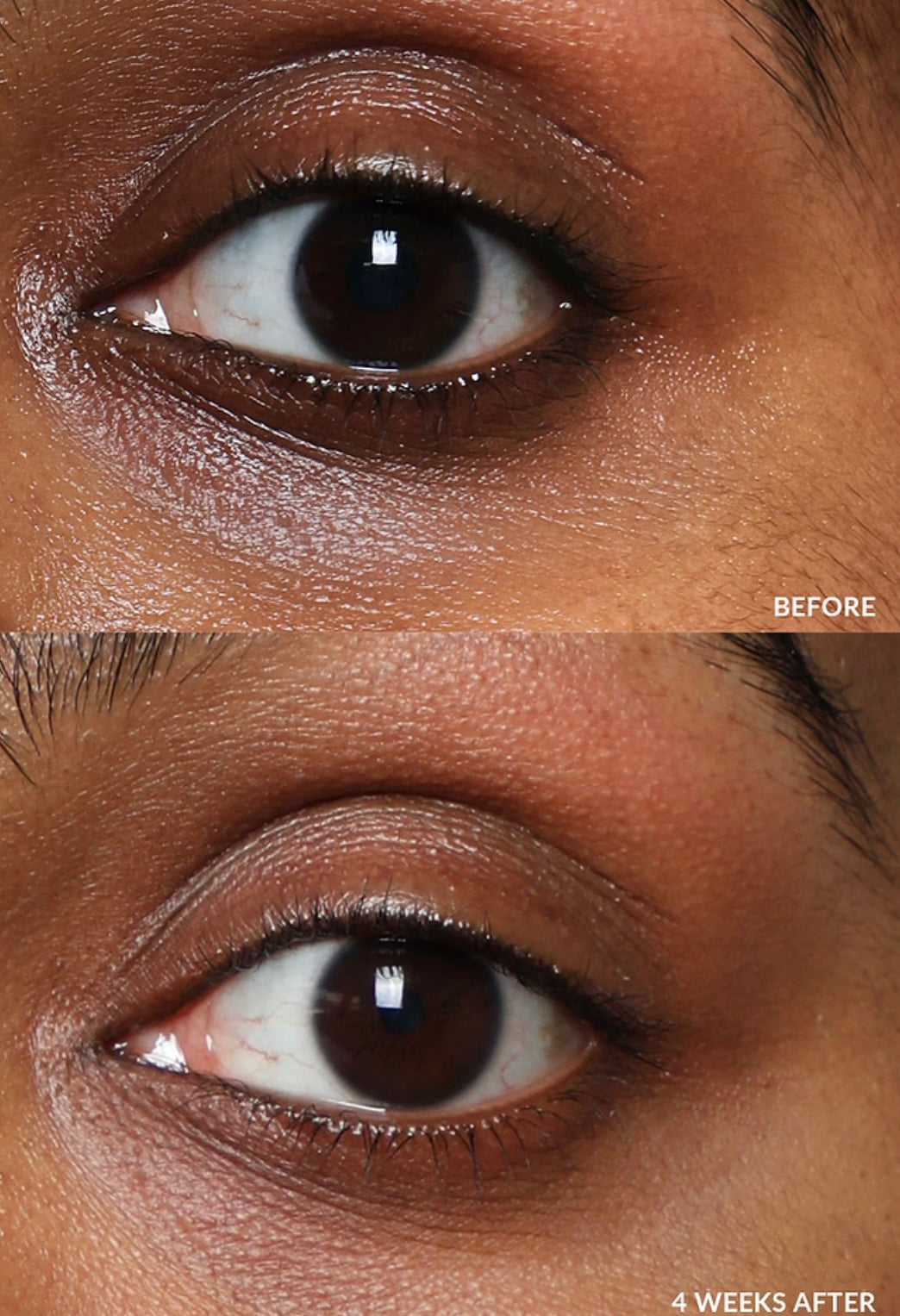 Eye Balm